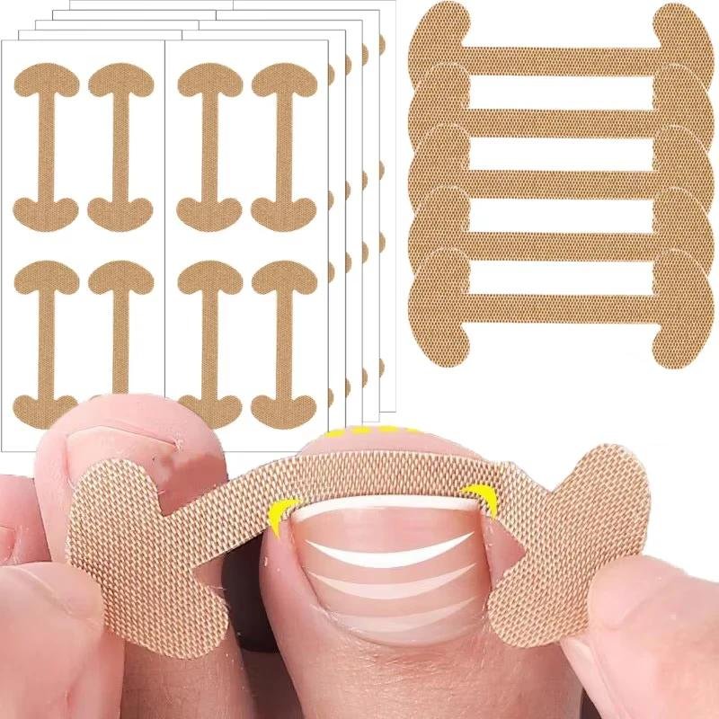 17774-e64996.jpeg Adhesive Ingrown Toenail Corrector Toe Nail Care Treatment Pads (20-100PCS)